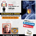 Radio Especial: CA Folicular de tiroides.